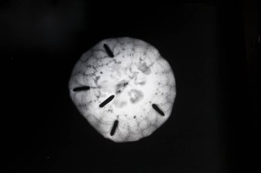 Kum dolarının X-Ray 'i