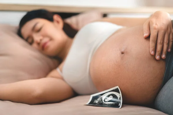 Mujer Embarazada Asiática Que Duerme Junto Imagen Ultrasonido Expectativa Niño — Foto de Stock