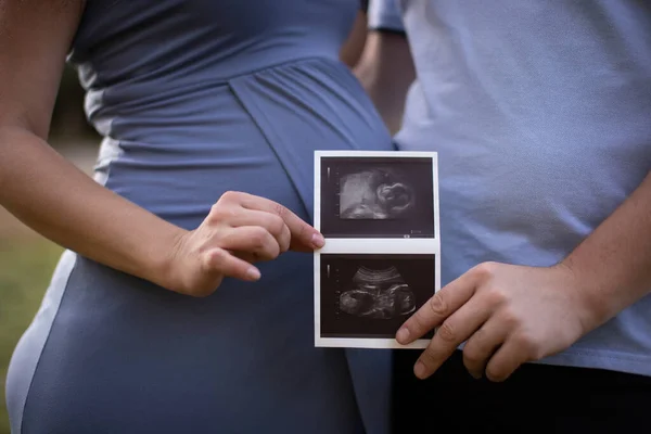 Hamile Kadın ve Kocası Ultrason görüntüsü tutuyorlar. Hamilelik, Sağlık, Jinekoloji, Tıp Konsepti. Genç Anne Bebek Bekliyor. Yakın plan..