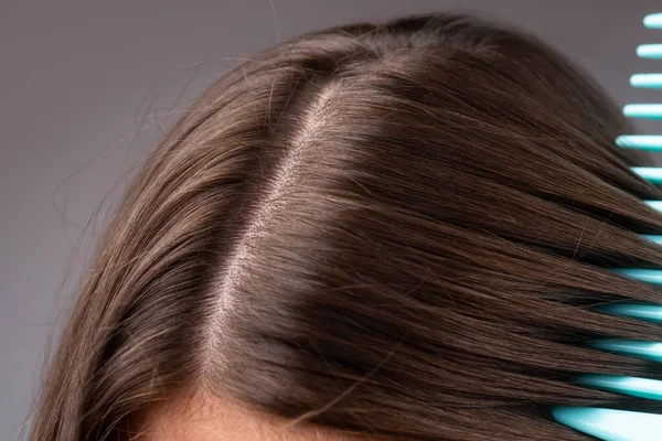 Gros plan cheveux problématiques. Macro soins capillaires et concept de perte de cheveux. — Photo