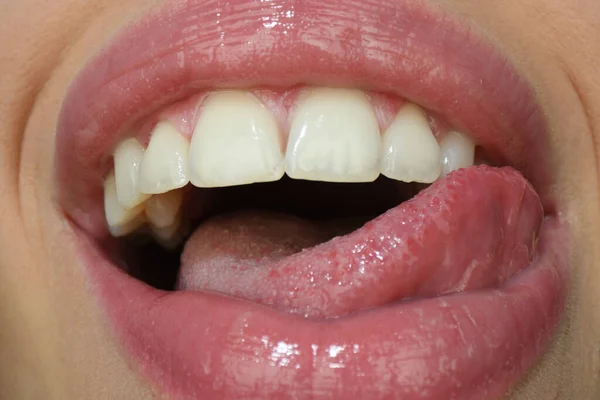 Sonriendo bocazas. Felicidad riendo y disfrutando de la boca icono, sonrisa alegre, concepto de emociones humanas. Felices labios de mujer. — Foto de Stock