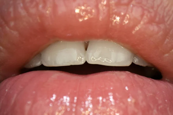セクシーな官能的な口。完全に開いた女性の口を閉じてください。健康な白い歯。官能的な女性の唇の形. — ストック写真