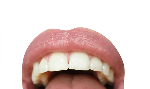 Dental care, healthy teeth and smile, white teeth in mouth. Close up macro of smile with white healthy teeth. — Stock Photo, Image