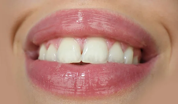 Zahnpflege, gesunde Zähne und Lächeln, weiße Zähne im Mund. Nahaufnahme eines Lächelns mit weißen gesunden Zähnen. Offener Mund. — Stockfoto