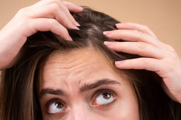 Primer plano de la mujer examinando su cuero cabelludo y el cabello, pérdida de cabello en la línea del cabello o problema de cuero cabelludo seco. —  Fotos de Stock