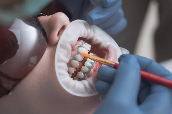 Portrait rapproché d'une patiente chez un dentiste de la clinique. Hollywood sourit aux placages. Dentiste en uniforme jetable dans une clinique dentaire moderne . — Photo