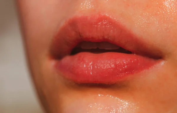 Lip balm. Lipcare lipstick. Close-up of sexy lips. Gloss makeup. Filler Injections, Plastic Surgery, Collagen and Treatments. — Stock Photo, Image