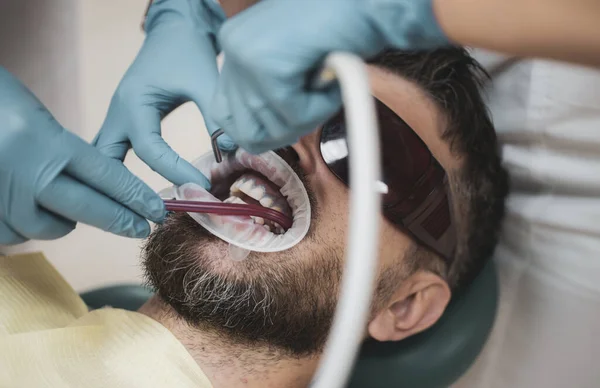 Przystojny mężczyzna w biurze Dentyści. Kobieta dentysty sprawdzanie zęby pacjenta z lustrem w nowoczesnej kliniki stomatologiczne. Należy sprawdzić, czy młody człowiek przez stomatologa na jasnym tle niewyraźne. — Zdjęcie stockowe