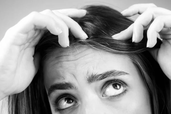Mujer con problemas de pérdida de cabello. Retrato de una joven calva. Foto de la cabeza de una chica nerviosa con un cepillo. —  Fotos de Stock