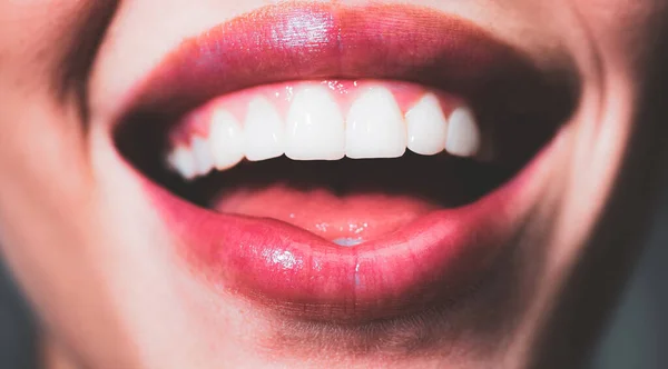 Lachende tanden. Lachende vrouwenmond met grote tanden dicht. Gezonde witte tanden. Close-up van de glimlach met witte gezonde tanden. — Stockfoto