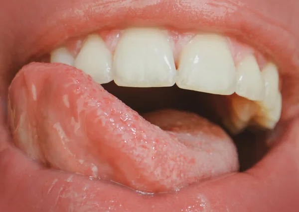 Dental care, healthy teeth and smile, white teeth in mouth. Closeup of smile with white healthy teeth. Open mouth, tongue touches the teeth. Extreme close up mouth, macro sexy lip.