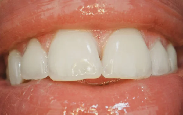 Bouche riant avec lèvres rouges. Extrême bouche fermée, lèvre macro sexy. Soins dentaires, dents saines et sourire, dents blanches dans la bouche. Bouche ouverte. — Photo