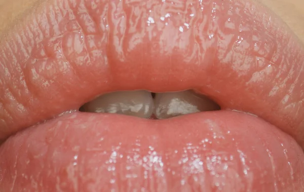 Filler injections, tender lips. Sensual female mouth. — Stock Photo, Image