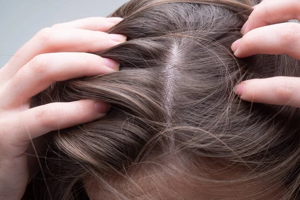 Zbliżenie kobiety badającej jej skórę głowy i włosów, wypadanie włosów na linii włosów lub suchy problem skóry głowy. — Zdjęcie stockowe