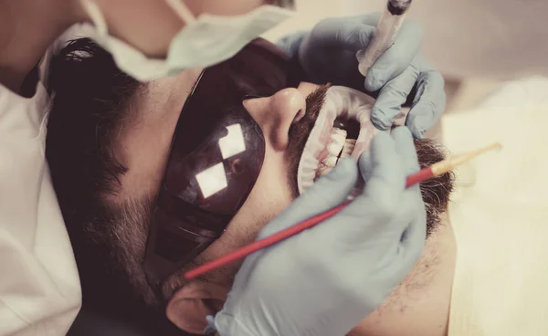 Blanchiment des dents à la lumière ultraviolette - lampe UV. Homme au cabinet de dentistes ayant un traitement dentaire. Homme choisissant la couleur des dents chez le dentiste . — Photo