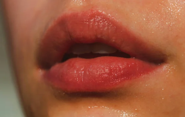 Injections, chirurgie plastique, collagène et soins de beauté. Baume à lèvres. Rouge à lèvres soin des lèvres. Gros plan sur les lèvres sexy. — Photo