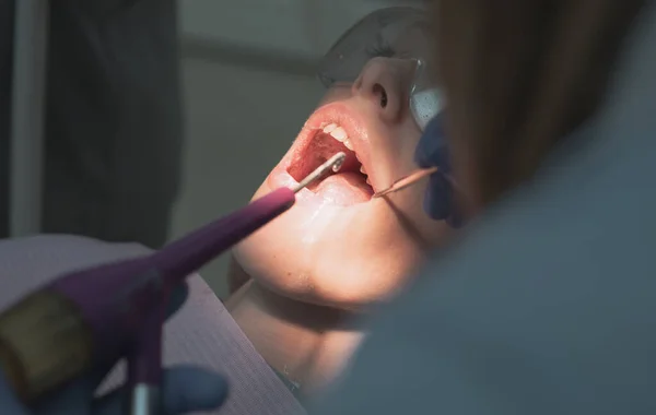 Portrait rapproché d'une patiente chez un dentiste de la clinique. Belle fille en chaise dentaire à l'examen chez le dentiste. Résultat du blanchiment des dents. Remplissage des dents lampe ultraviolette. — Photo