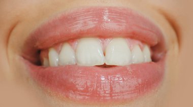 Diş bakımı, sağlıklı dişler ve gülümseme, ağzında beyaz dişler. Sağlıklı beyaz dişlerle gülümseme. Ağzını aç..