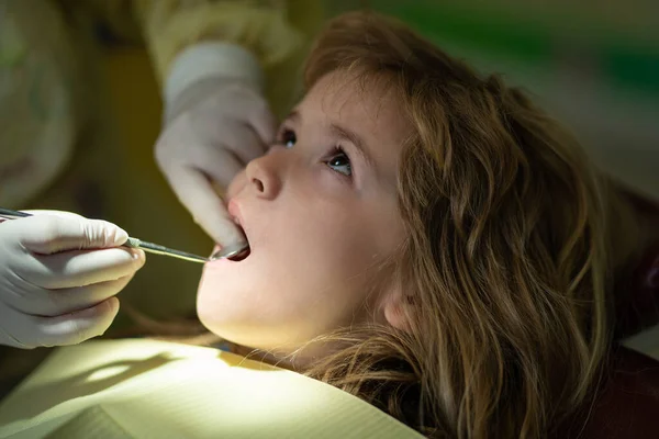牙齿检查在牙医，检查牙齿关闭。牙科医生检查坐在牙医椅子上的小孩的牙齿.治疗牙齿儿童、用仪器检查口腔、口腔科. — 图库照片