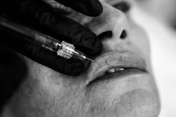 Primeros labios de mujer, aumento del procedimiento. Jeringa de boca femenina, inyección de ácido hialurónico, aumento. Cambios de edad. Cosmetología Tratamiento. —  Fotos de Stock