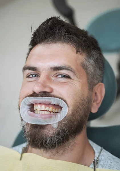Bel homme européen sourire avec des dents saines blanchissant. Dentiste comparant le blanchiment des dents de sa patiente en clinique dentaire. Dentiste examinant les dents des patients en clinique . — Photo
