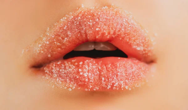 Labios. Labio de primer plano con azúcar. Tratamientos de belleza. Cosméticos para el cuidado de los labios. —  Fotos de Stock