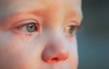 Gökyüzü mavisi gözlü sulu göz. Küçük hassas oğlan ağlıyor. Göz damlası, küçük tatlı çocuğun gözyaşı damlası. Duygusal bebek annesini özlüyor. Çocukluk kavramı.