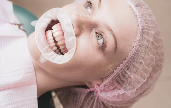 Happy woman smiling on an abstract background with blurred lights. Healthy white smile. Brush your Teeth. Matching the shades of the implants or the process of teeth whitening. — Stock Photo, Image