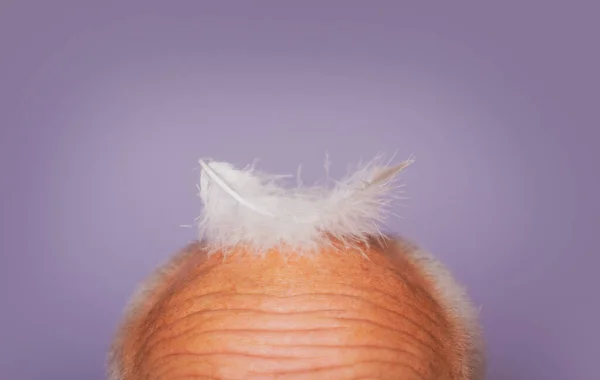 Kel yaşlı adam kafası. Kıdemli kellik erkeği. Saç kaybı, sağlık sorunları, yaşlanma, saç tedavisi ve saç dökülmesi. — Stok fotoğraf