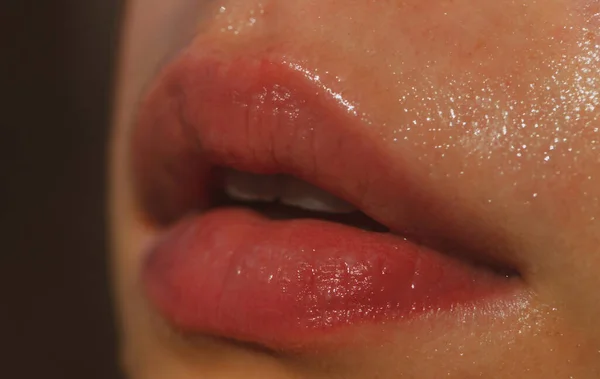 Close-up van natte lippen. Lippen met glanzende make-up. Vulinjecties, plastische chirurgie, collageen en behandelingen. — Stockfoto