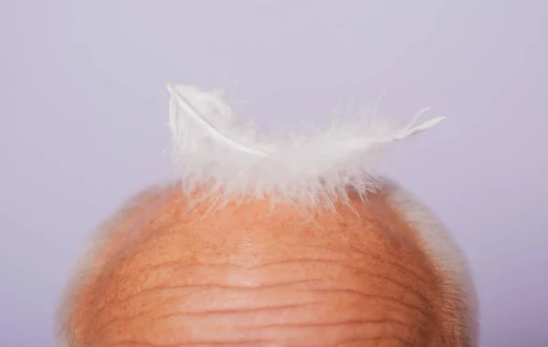 Догляд за старшим чоловіком. Крупним планом старий лисий чоловік. Випадання волосся, облисіння, проблеми зі здоров'ям, старіння . — стокове фото
