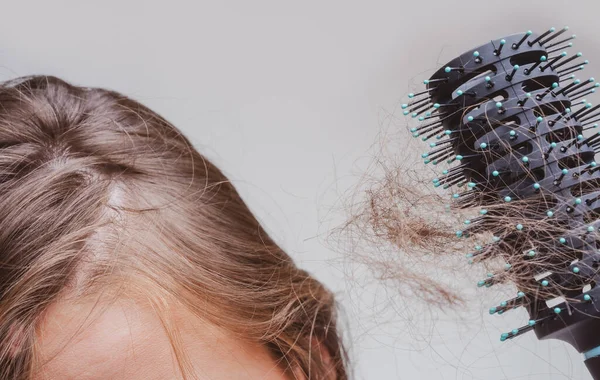 Pérdida Cabello Cerca Problema Enredado Cabello Macro —  Fotos de Stock