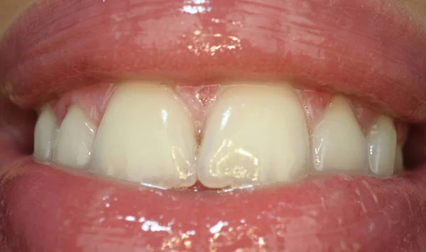 口の中で赤い唇で笑う 極端な口を閉じて マクロセクシー唇 歯のケア 健康的な歯と笑顔 口の中で白い歯 白い歯 歯の背景 — ストック写真