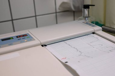 Elektrokardiyografi, yakın plan. Not defteri hamile. Yüksek kalite fotoğraf