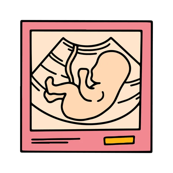 Ultrazvukový snímek s embryo dítětem, těhotenský scan — Stockový vektor