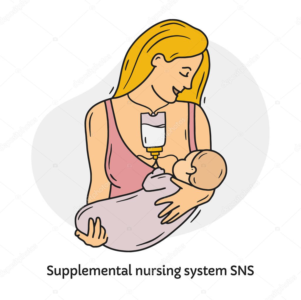 A woman breast-feeds a baby with supplemental nursing system SNS