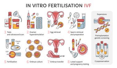 Vitro döllenme tüp bebek vektör infografik ve kısırlık tedavi şemasında. Yumurtalık hiperstimülasyonu, yapay döllenme, embriyo kültürü ve dondurma. Hamilelik için tıbbi prosedür
