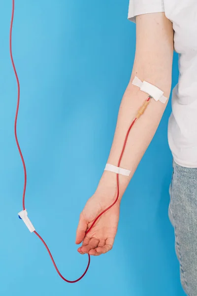Hand with infusion set for blood collection — 스톡 사진