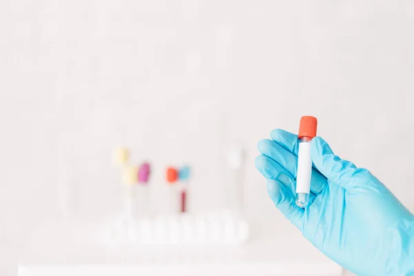 Hand holding plastic flask against the background of test tubes — Photo