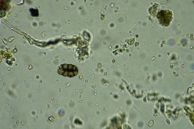 Su damlalarının soyut arkaplanı