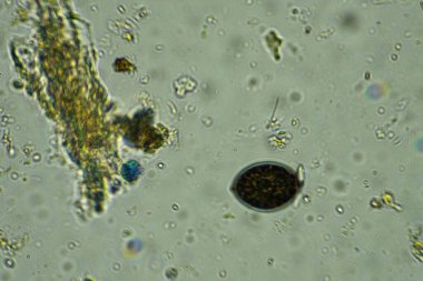 Nehrin yüzeyine su damlıyor..