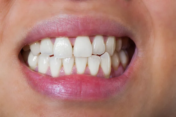 The Teeth — Stock Photo, Image