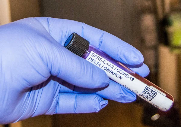 Blood Sample Corona Test Cov Delta Omikron — Stockfoto