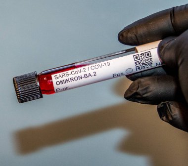 Cov-19 - Delta - Omikron-BA.2 salgın virüsü testi.