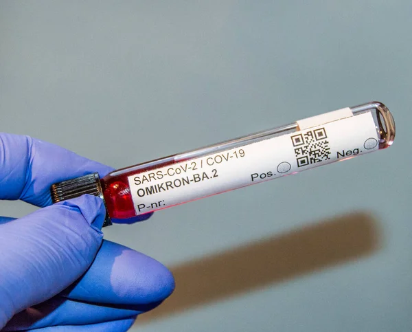 Cov-19 - Delta - Omikron-BA.2 salgın virüsü testi.