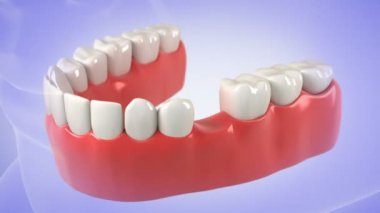 diş implantı yükleme işlemidir. HD