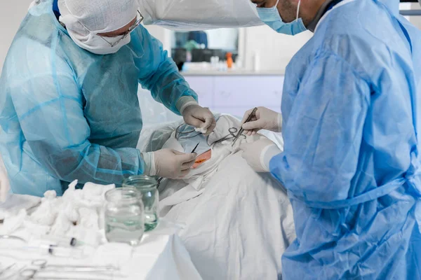 복부는 수술실에서 수술하기 메스로 외과의사는 메스로 절개를 합니다 병원에서 외과용 — 스톡 사진