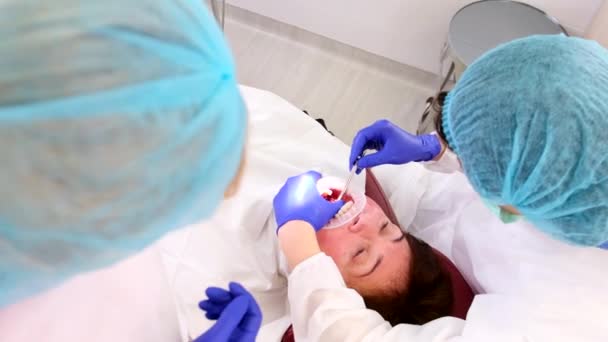 Ağzı açık ve stomatolojist aletlerle çalışan bir hastanın dişçi koltuğunda yattığını gösteren en iyi görüntü.. — Stok video