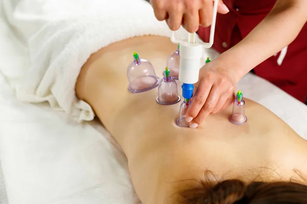 Close-up of young woman lying with banks on her back in spa salon, vacuum banks in treatment and cosmetology. — Stock Photo, Image