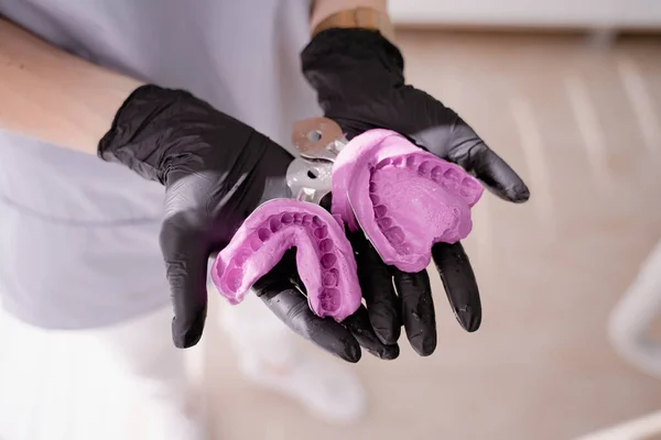 Ortodontistin ellerinde iki diş izi var. Üst ve alt diş izleri